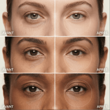 Patchs Hydrogel Anti-cernes & Anti-poches
