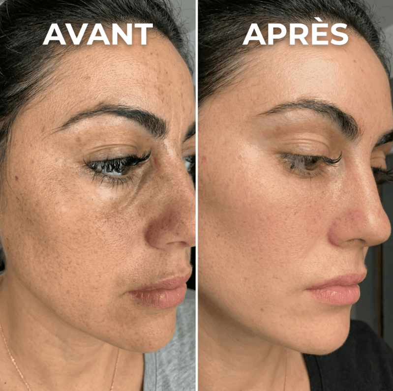 Exfoliant Coréen Peel Shot