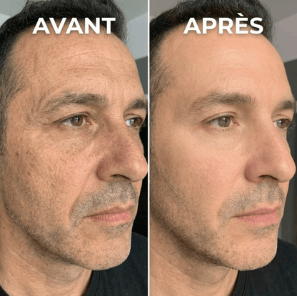 Exfoliant Coréen Peel Shot