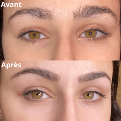 Mazenzo SilkGlide Pro™ – Épilateur visage 2-en-1