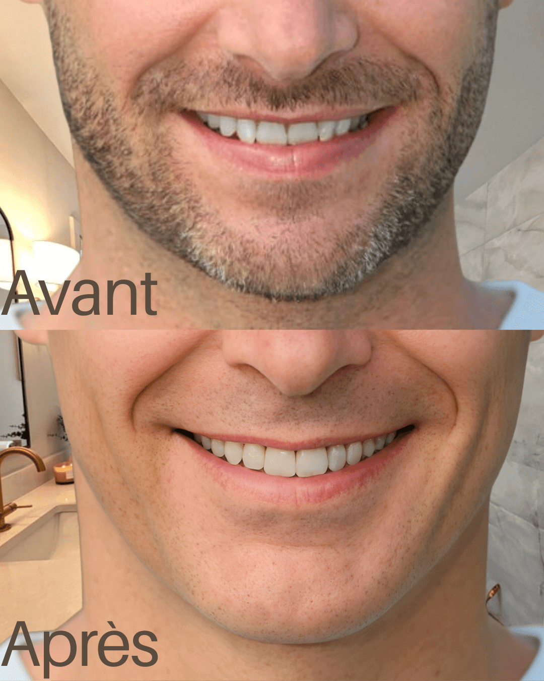 Mazenzo R18 – Rasage doux pour peaux sensibles