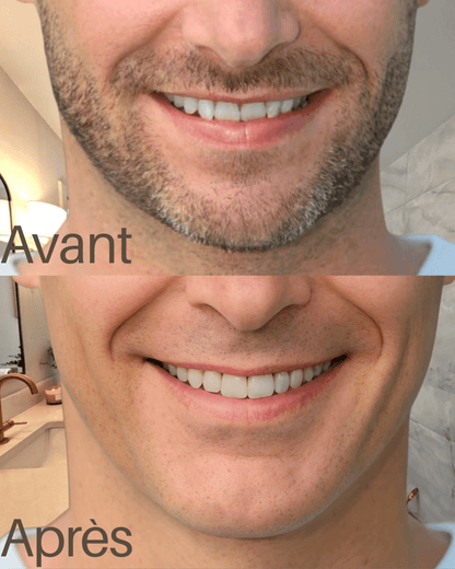 Mazenzo R18 – Rasage doux pour peaux sensibles