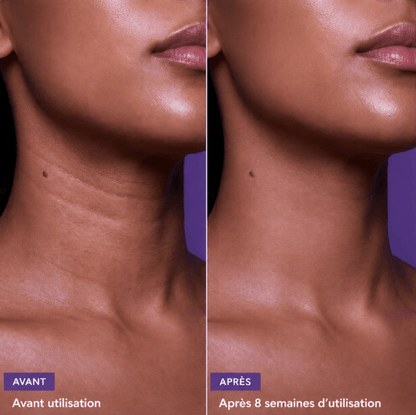 Mazenzo SculptLift™ – Soin Liftant Gua Sha au Rétinol