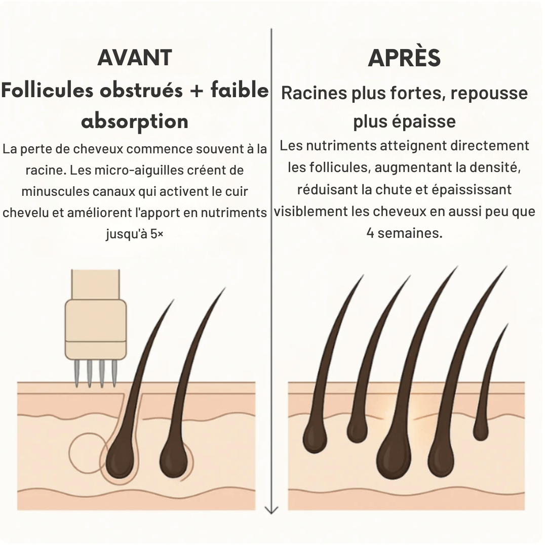 Mazenzo Micro Infuse - Hair Growth Activator