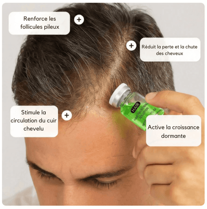 Mazenzo Micro Infuse - Hair Growth Activator