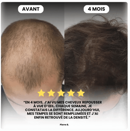 Mazenzo Micro Infuse - Hair Growth Activator