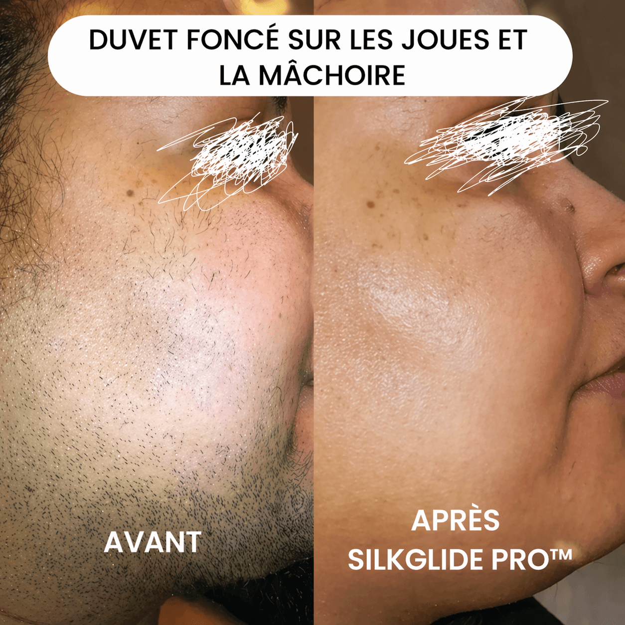 Mazenzo SilkGlide Pro™ – Épilateur visage 2-en-1