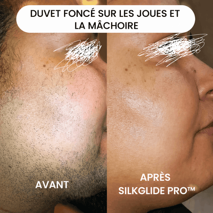 Mazenzo SilkGlide Pro™ – Épilateur visage 2-en-1